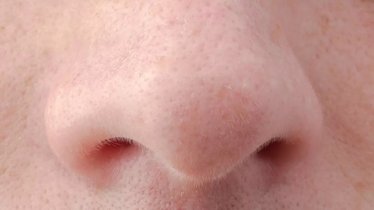 Hidung tidak bisa mencium bau