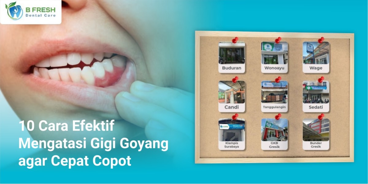 5 Cara Mengatasi Gigi Goyang Secara Alami | Dokter Gigi