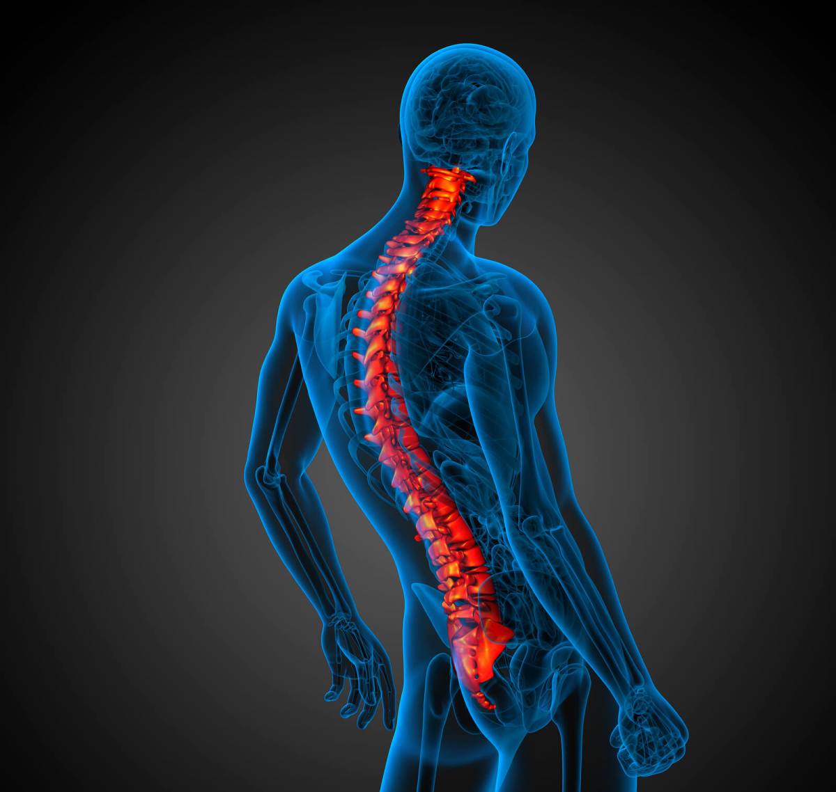 Kelainan tulang belakang